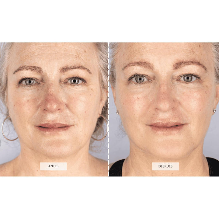 Máscara Facial de Terapia de Luz LED CurrentBody Skin | Dispositivo...