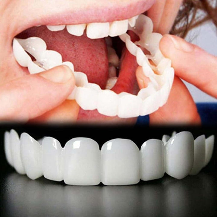 2 pares de carillas de dientes para mujeres y hombres, kit de reemp...