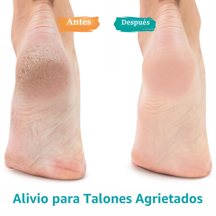 GILDEN TREE Gel de urea 42 % para pies, máxima fuerza, suaviza los...