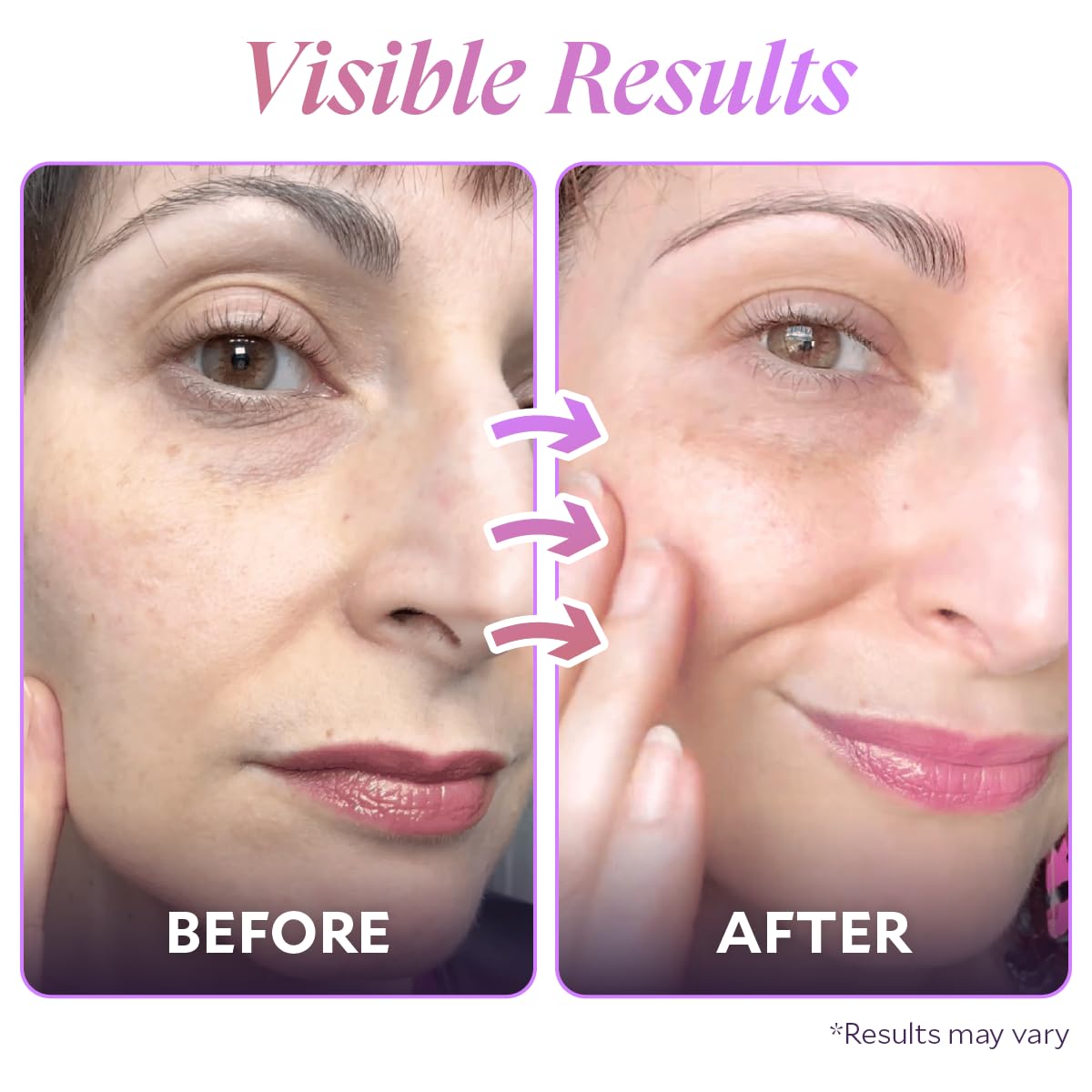 Fièra Bakuchiol Tratamiento Facial Rejuvenecedor - Retinol Alternat...
