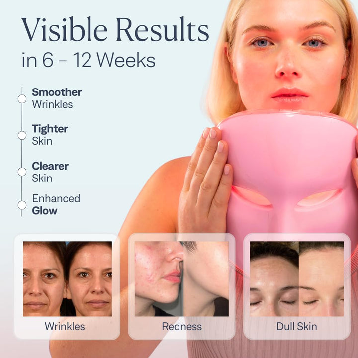 VogueNow Máscara facial con luz LED, kit de spa de primera calidad...