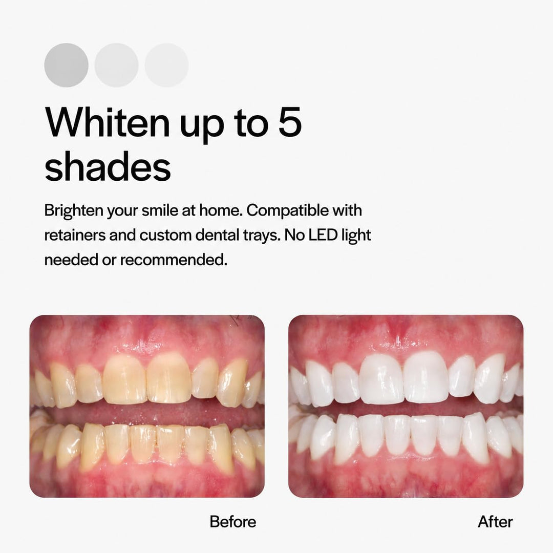 Opalescence Kit de recambio de blanqueamiento dental con jeringas d...