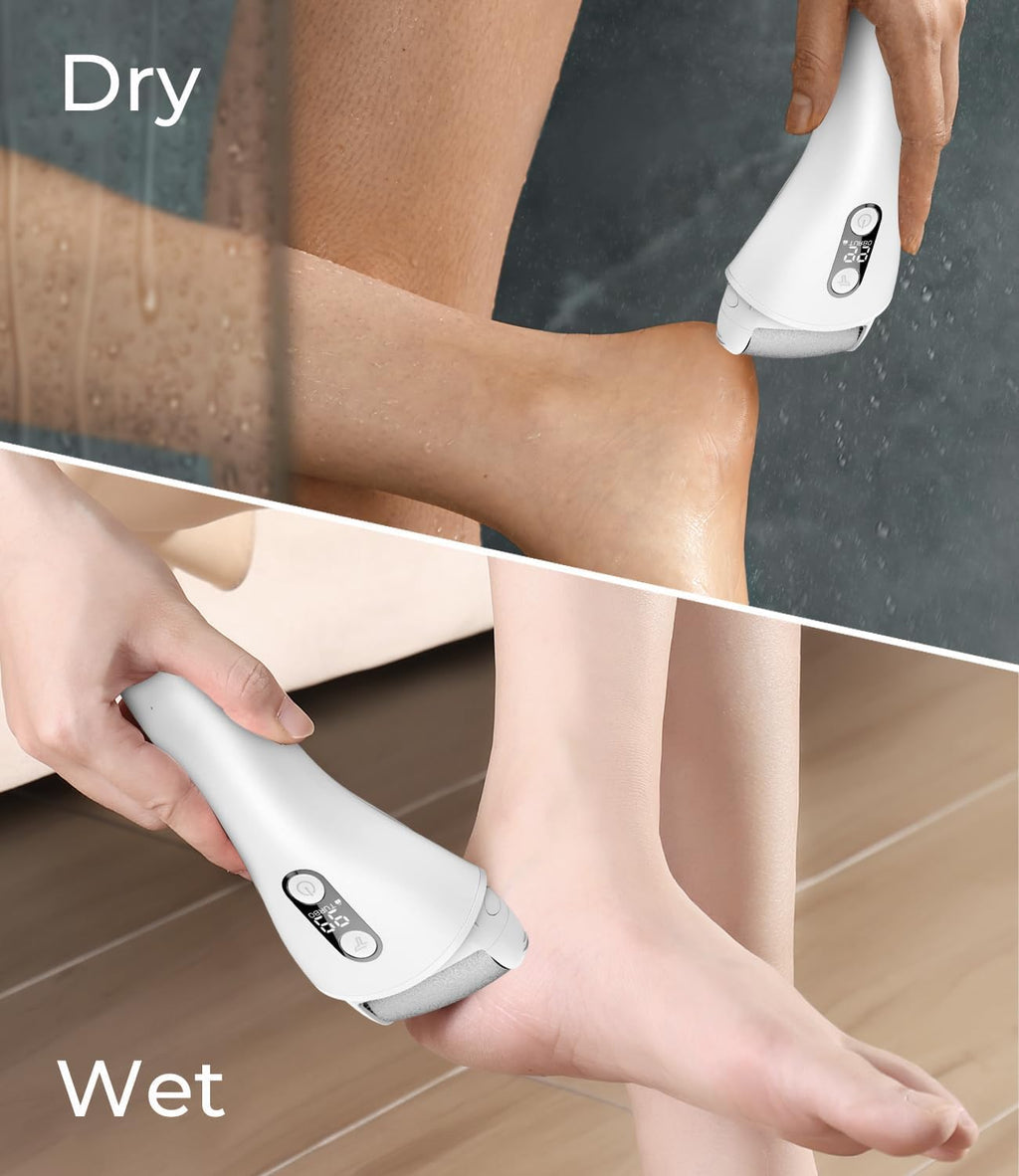 PRITECH - Removedor eléctrico de callos para pies, kit de herramientas de pedicura electrónica recargable para eliminación de callos, limpiador eléctrico impermeable para pies con 3 rodillos de
