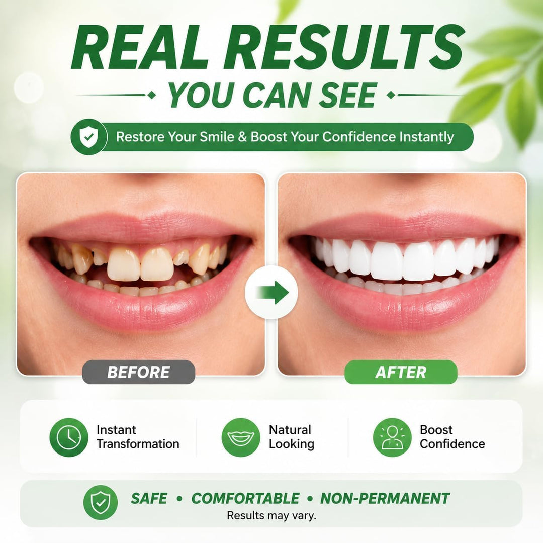 2 pares de carillas de dientes para mujeres y hombres, kit de reemp...