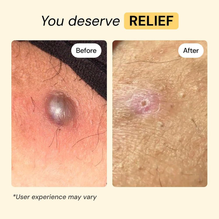 MyMagicHealer Universal Flare Care | Pomada Extractora para HS, for...
