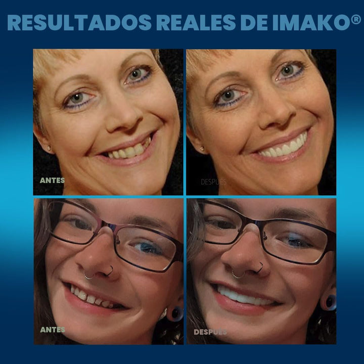 Imako Parte superior cosmética prémium para hombres y mujeres, camb...