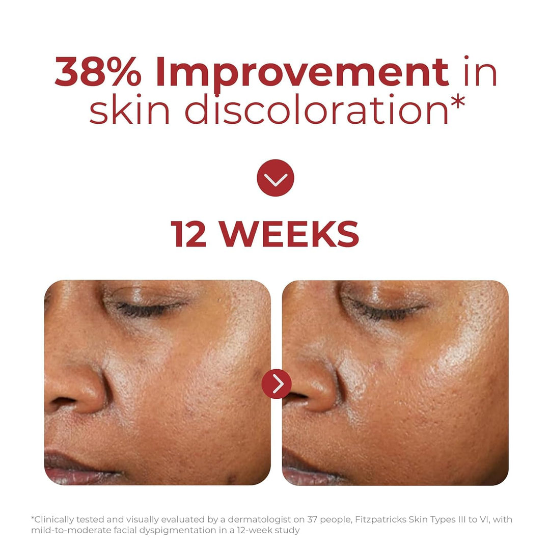 EltaMD UV Clear Face Sunscreen SPF 46, Oil-Free Sunscreen with Zinc...