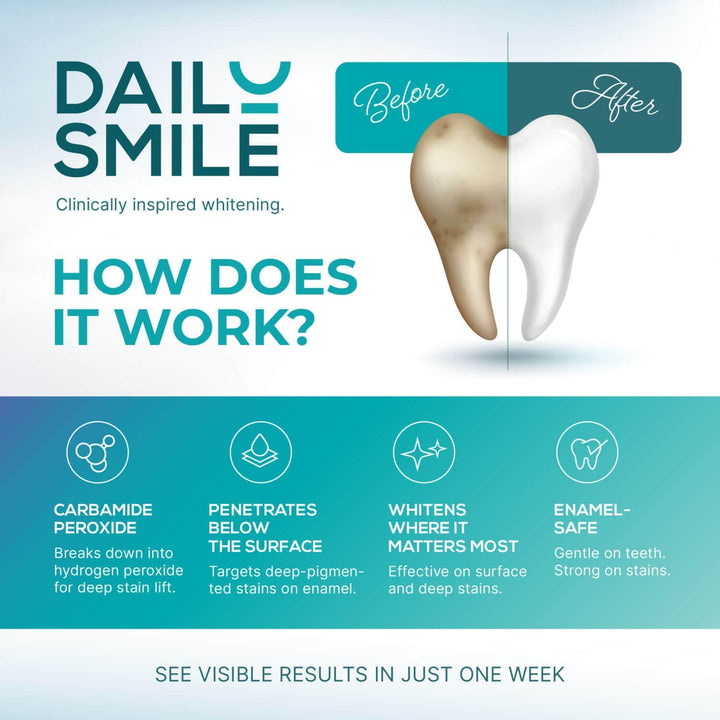 Kit de Blanqueamiento Dental DailySmile con LED - Formulado para Di...