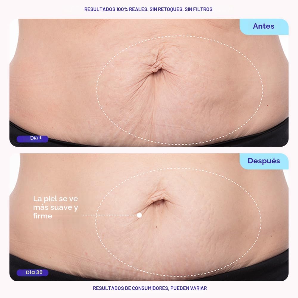 goPure Crema reafirmante para el vientre - Hidratante reafirmante c...