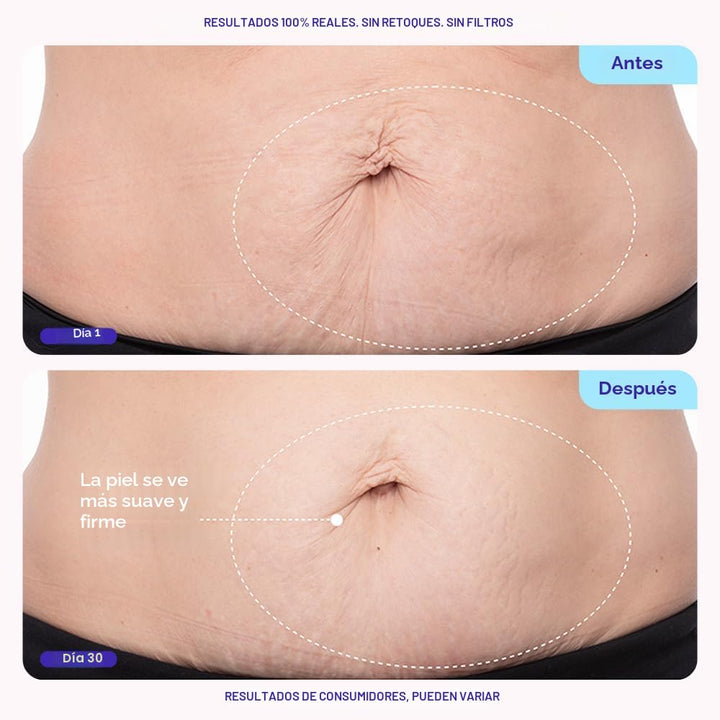 goPure Crema reafirmante para el vientre - Hidratante reafirmante c...