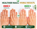 Oriundo Life Tratamiento de uñas | Tratamiento para uñas | 0.5 onza...