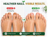 Oriundo Life Tratamiento de uñas | Tratamiento para uñas | 0.5 onza...