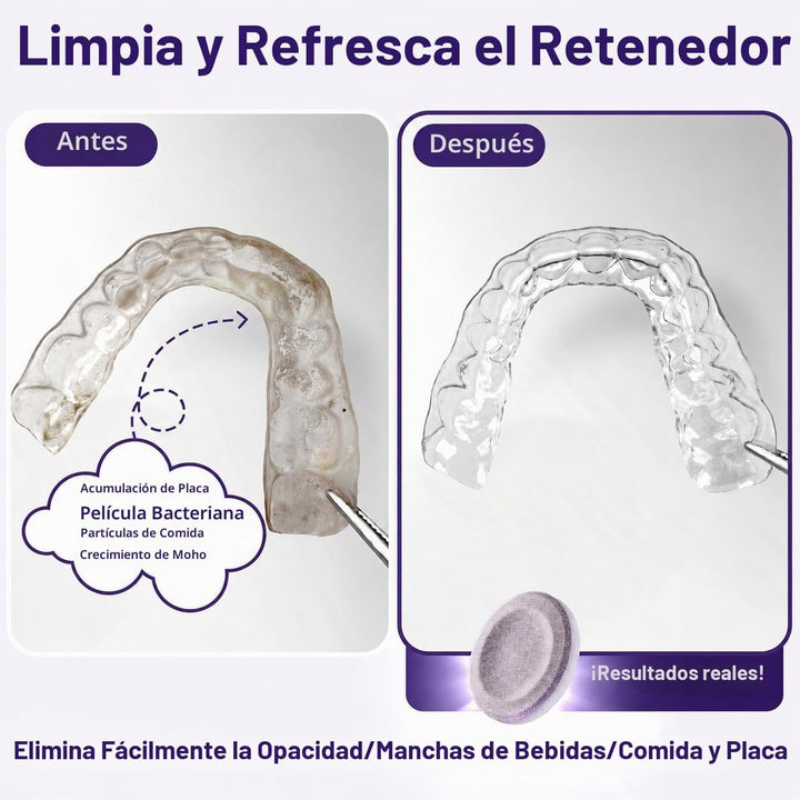 Weiss Naturals - Tabletas limpiadoras de retenedores, limpiador Inv...