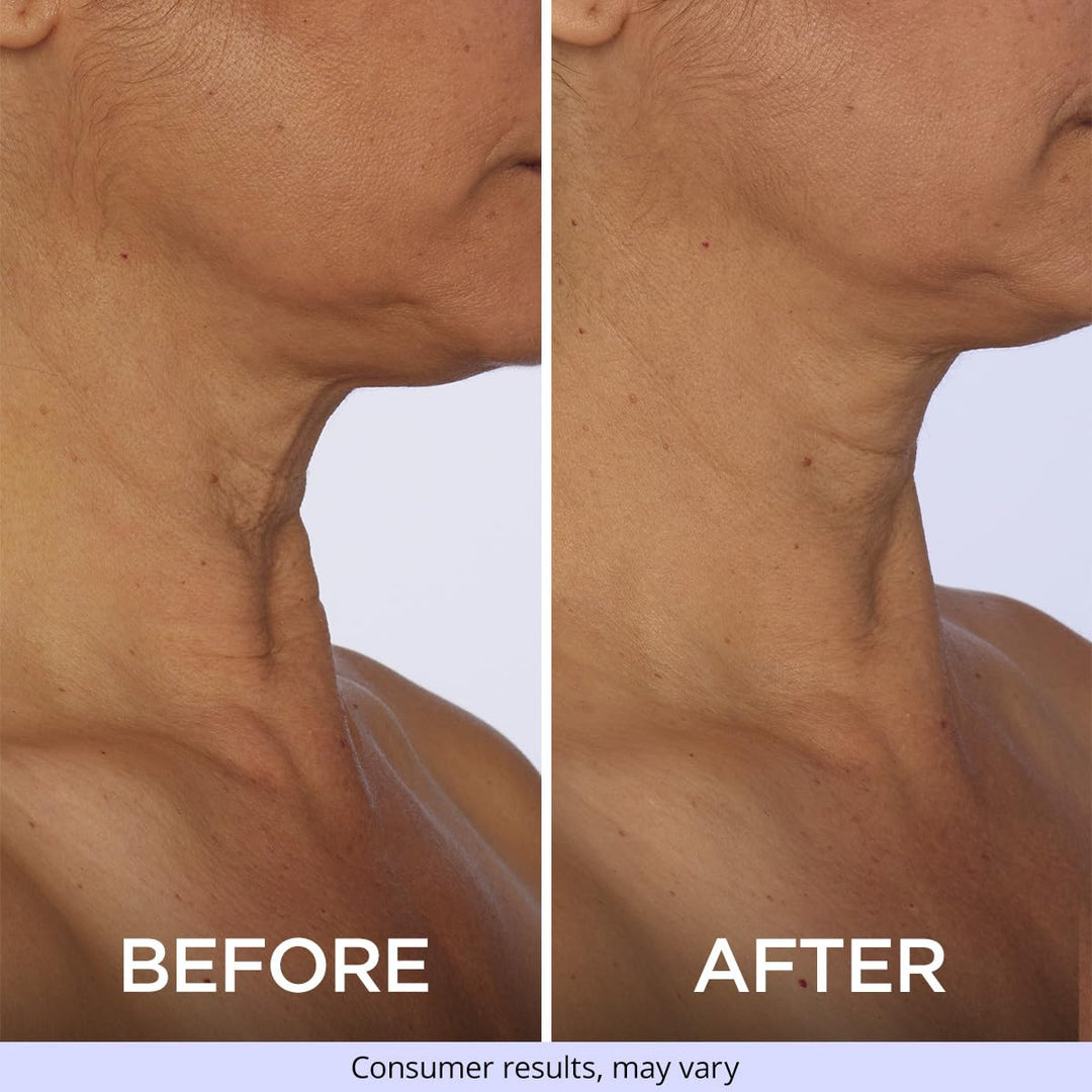 Crema hidratante para cuello y pecho goPure para reafirmar, tensar...