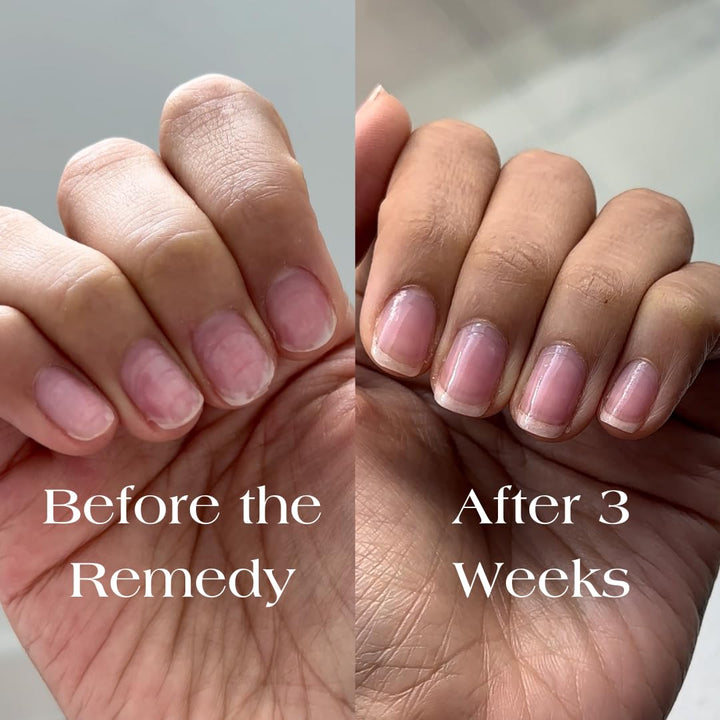 Botanist The Remedy | Esmalte fortalecedor para uñas | Repara y end...