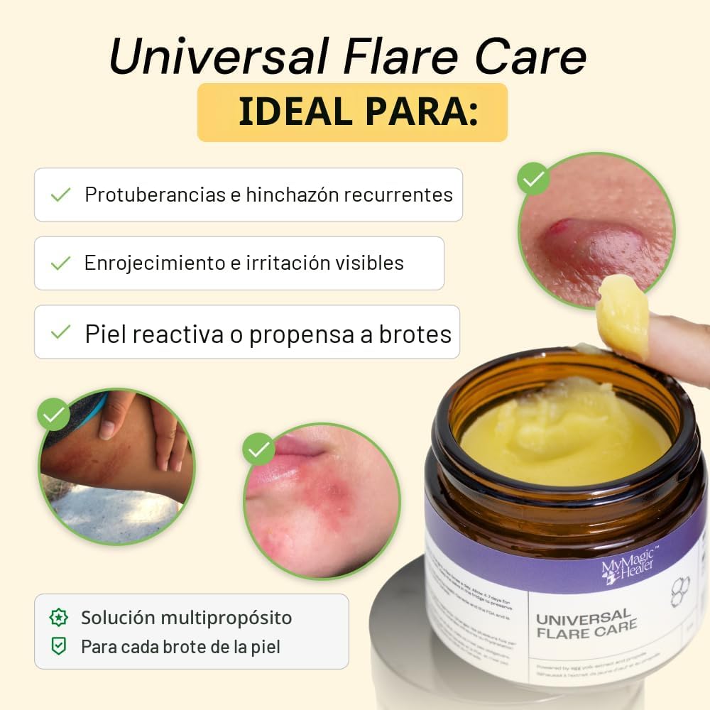 MyMagicHealer Universal Flare Care | Pomada Extractora para HS, for...