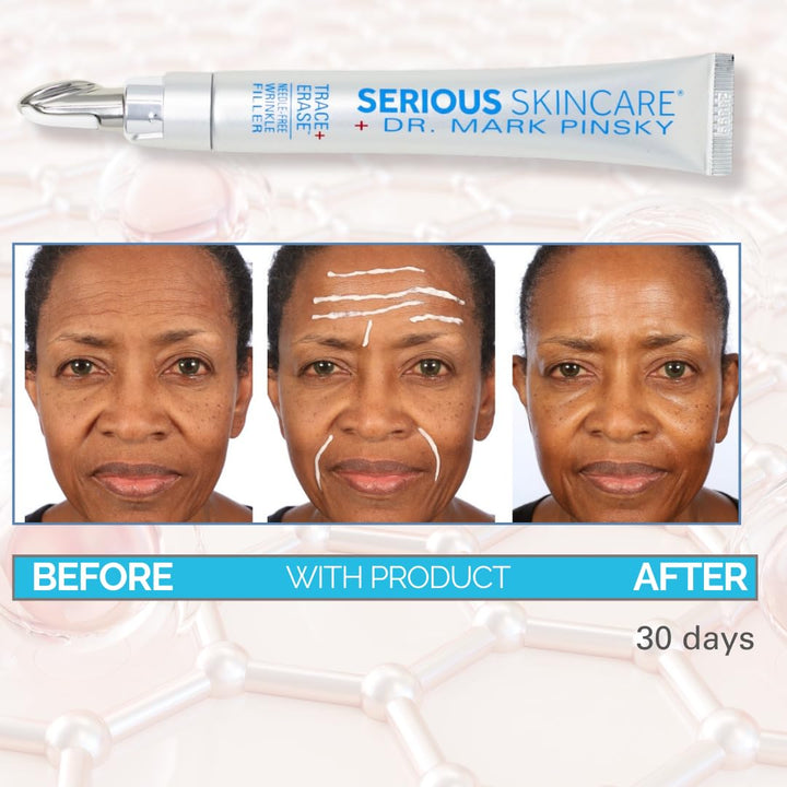 Serious Skincare Relleno profundo de arrugas para cara y cuello, Dr...