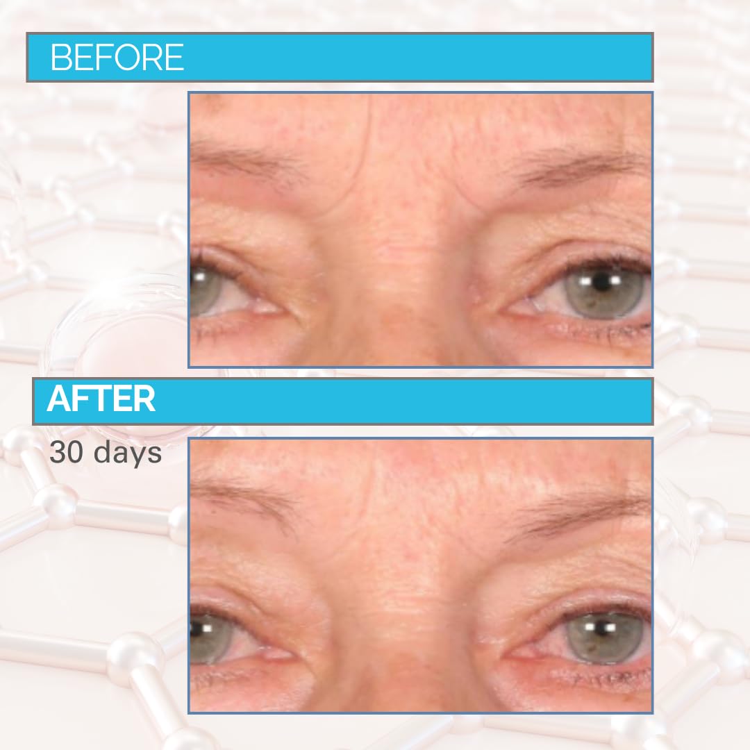 Serious Skincare Relleno profundo de arrugas para cara y cuello, Dr...
