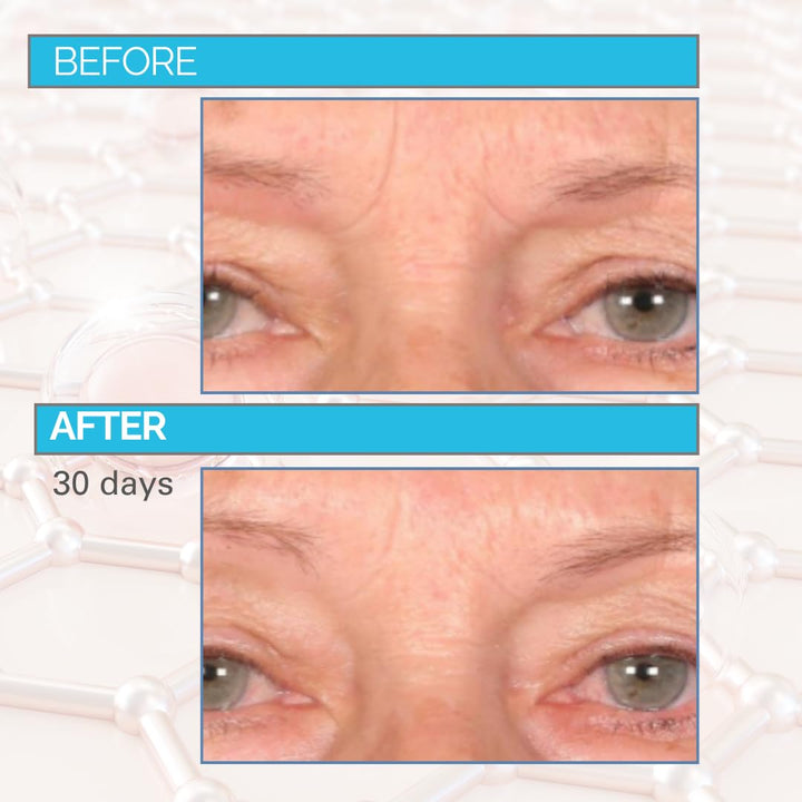 Serious Skincare Relleno profundo de arrugas para cara y cuello, Dr...