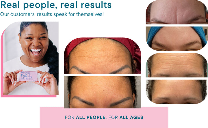 Parches faciales para la frente y el espacio entre los