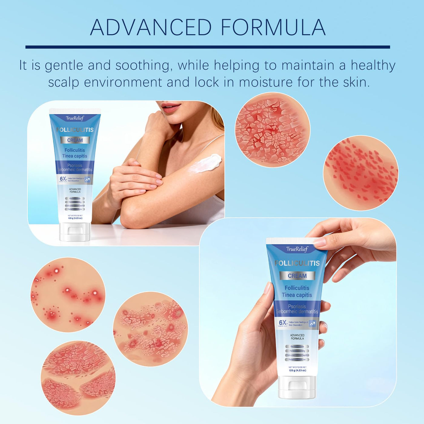 OUHENGTEK Crema de foliculitis | Alivia y ayuda a eliminar protuber...