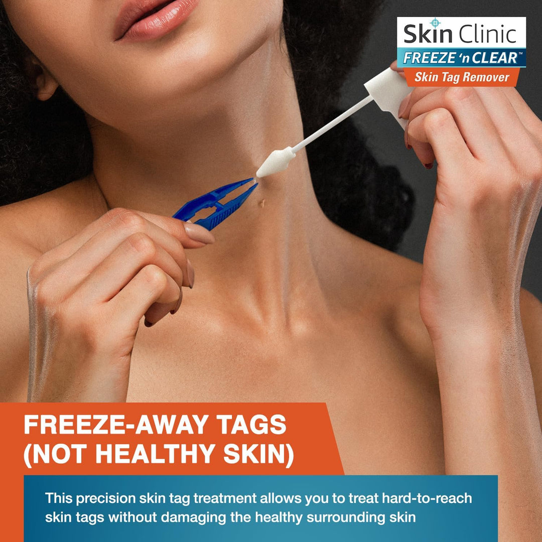 Skin Clinic Freeze n Clear Removedor de marcas cutáneas