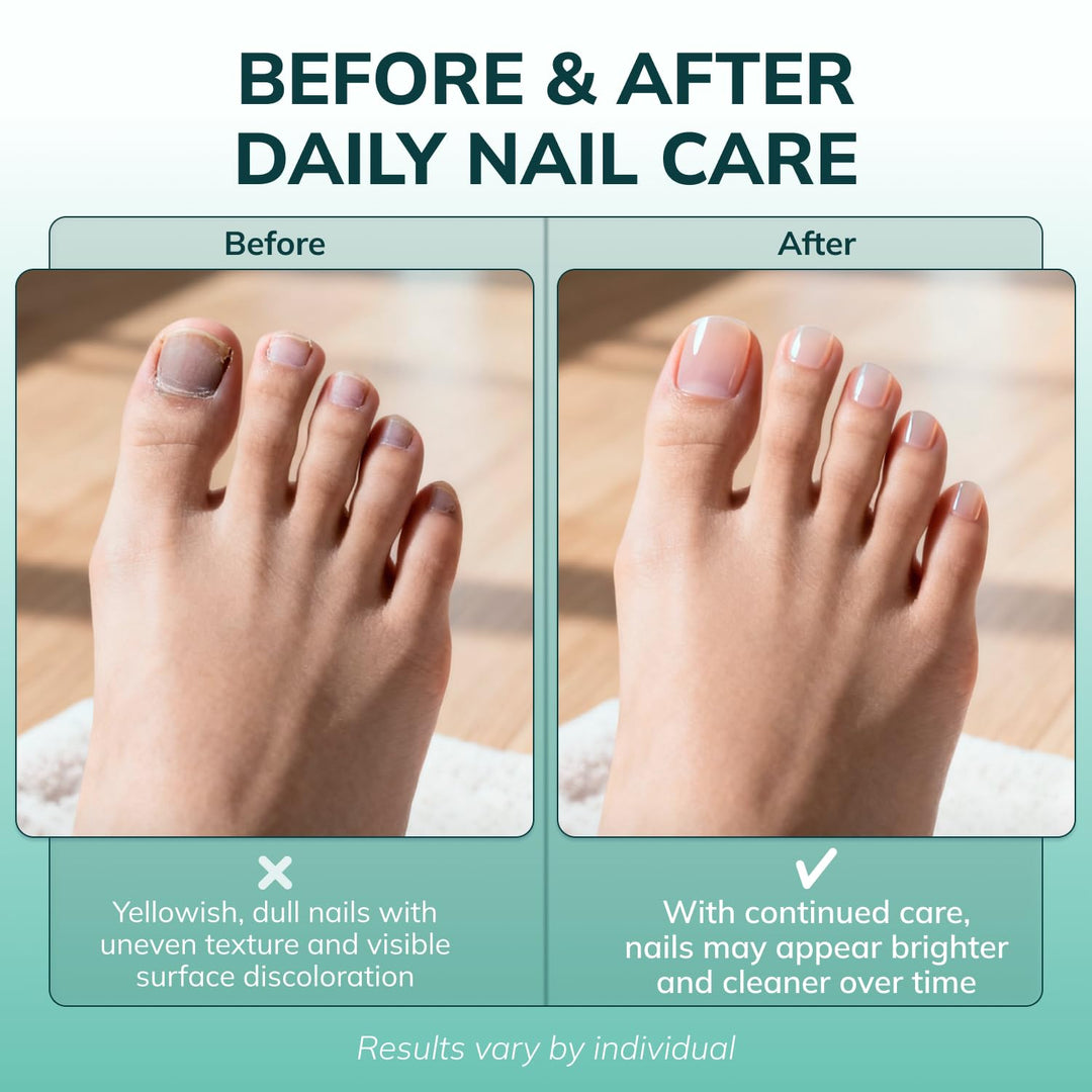 Swissklip Medi-Care Toenail Stick I KlearNail Treatment | Solución...