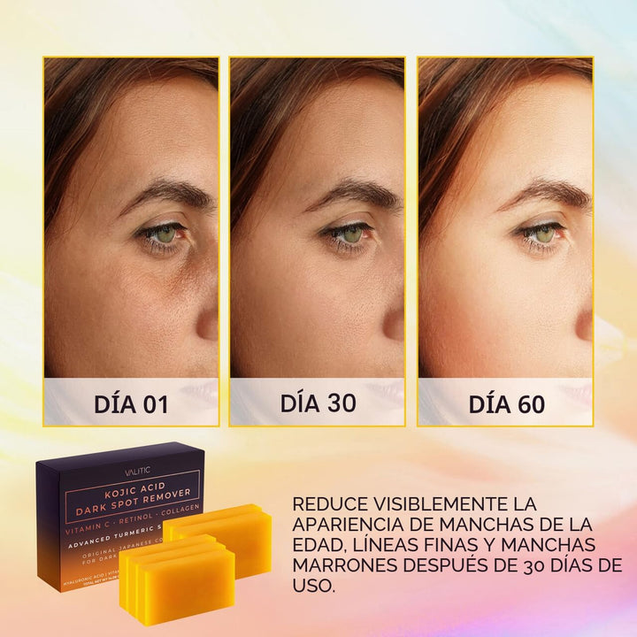 VALITIC Barras de jabón eliminadoras de manchas oscuras de ácido kó...