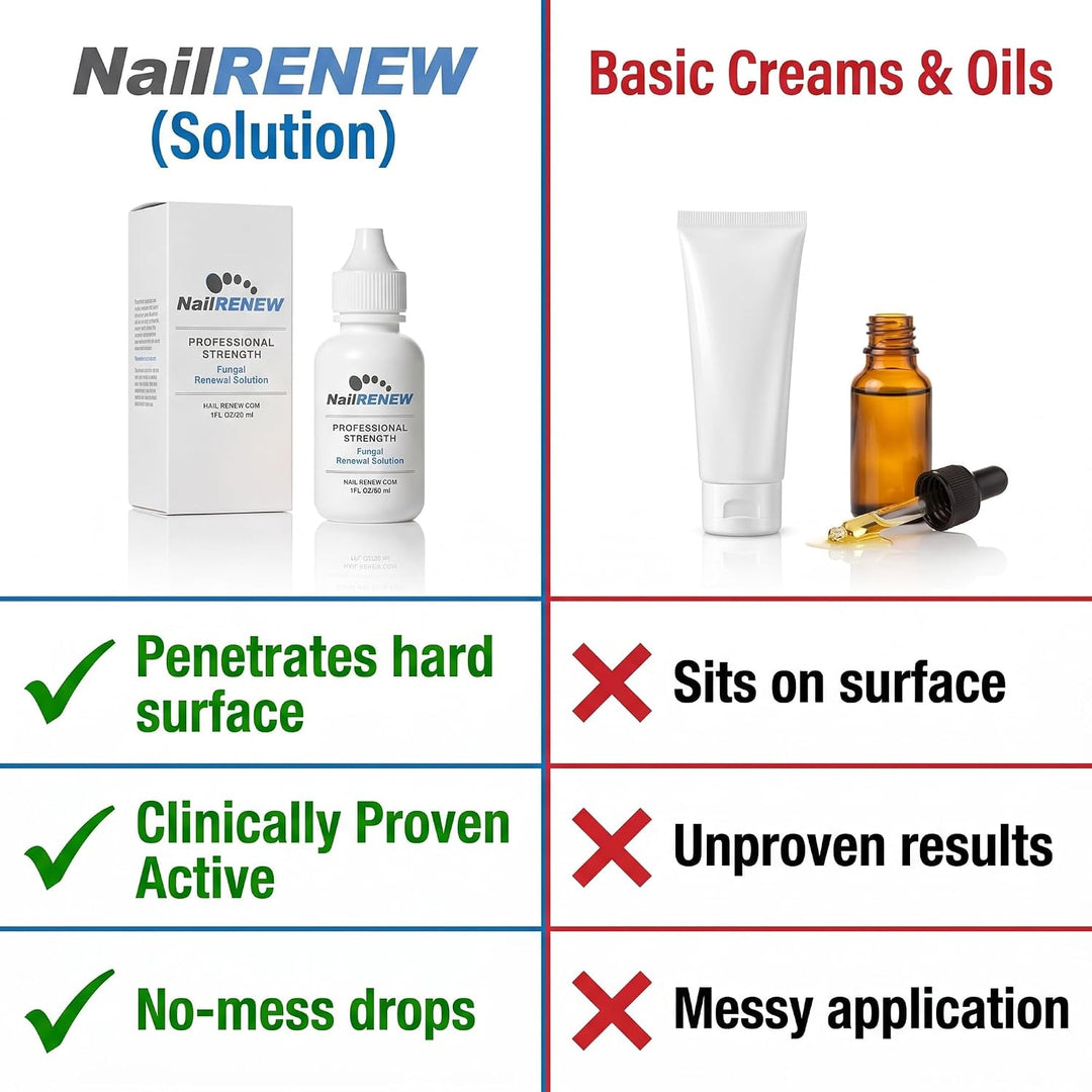 NailRENEW Antifúngico - Fuerza profesional, tratamiento de hongos c...