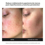 Paula's Choice BOOST Crema Gel Potenciadora de Ácido Azelaico a...