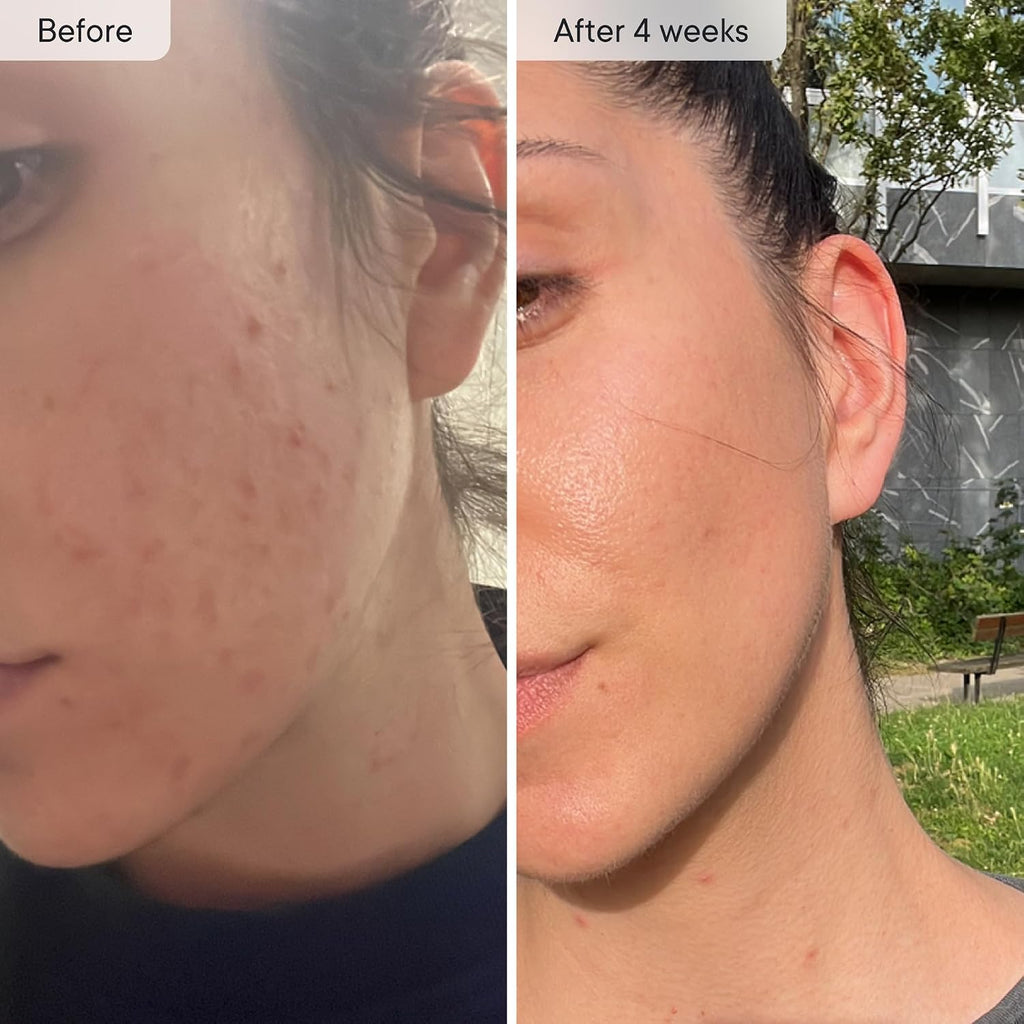 Qure Skincare - Grifo de agua con filtro para lavabo de baño, reduce el 99% de cloro y metales pesados, hidratación de la piel en 4 semanas, reduce la acumulación, equilibra el pH, piel y cabello más suaves, color plateado