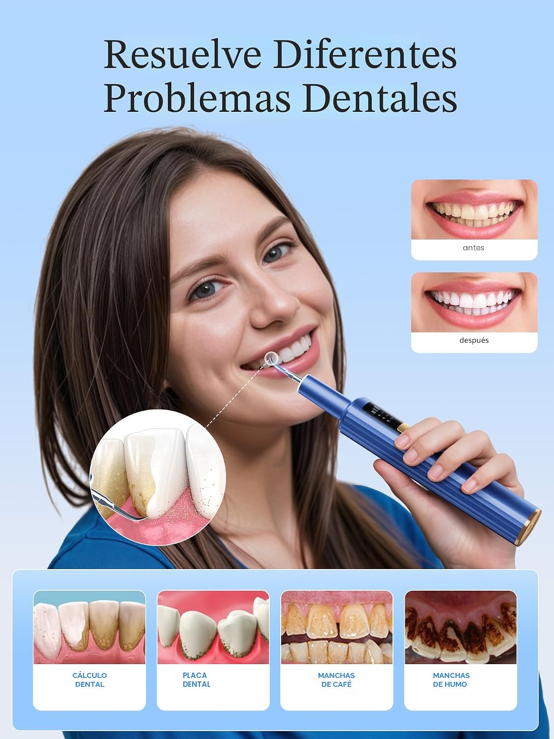 Removedor de placa para dientes, herramientas dentales, herramienta...
