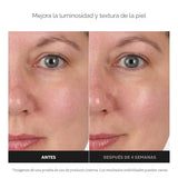 Paula's Choice TÓNICO FACIAL REDUCTOR DE POROS Y EQUILIBRADOR D...