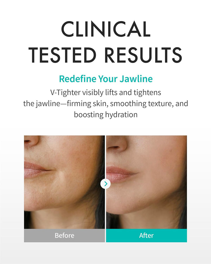 REJURAN® Perfect V Tighter Máscara Facial de Doble Lámina Reafirman...