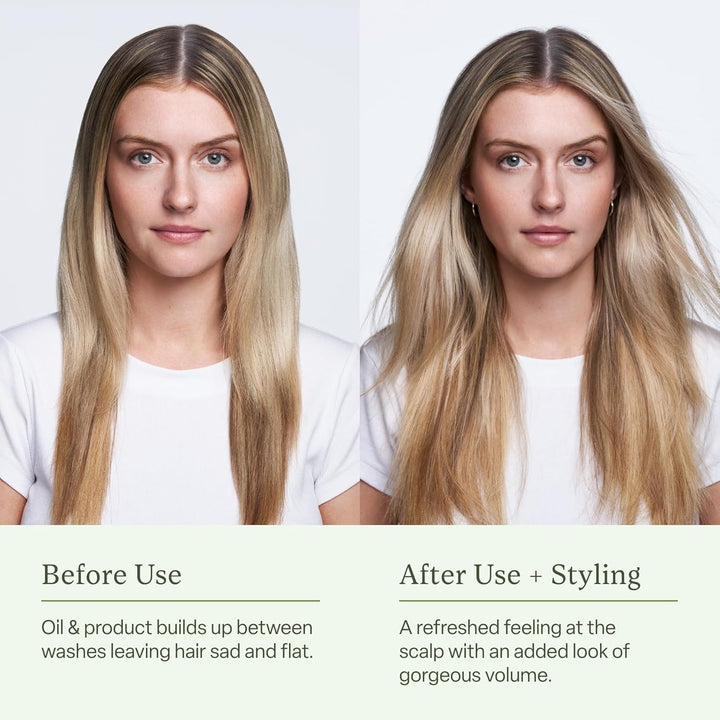 divi Champú en aerosol seco para mujeres, formulado para absorber a...