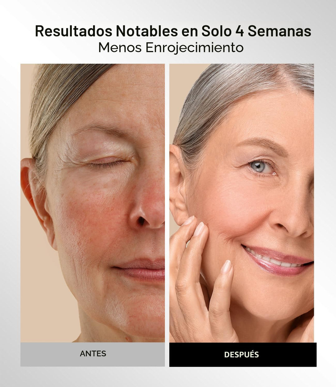 INIA Máscara de terapia de luz roja para cara, 4 modos de luz con N...