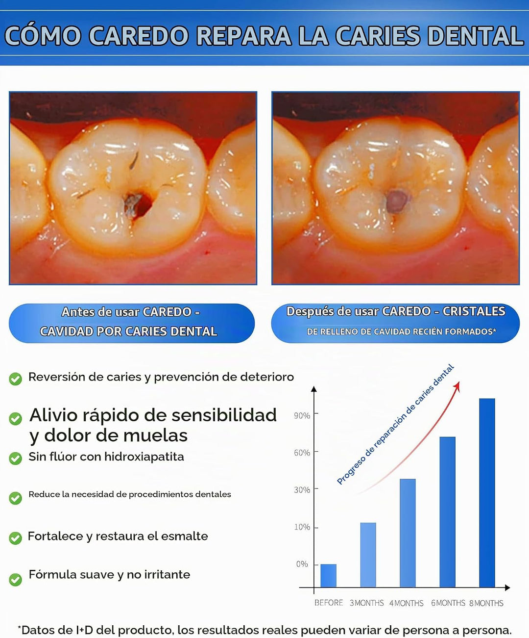 CAREDO Tratamiento de pasta de dientes para adultos, la única pasta...