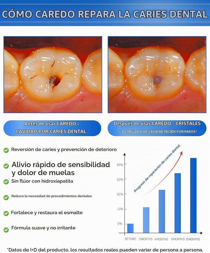 CAREDO Tratamiento de pasta de dientes para adultos, la única pasta...