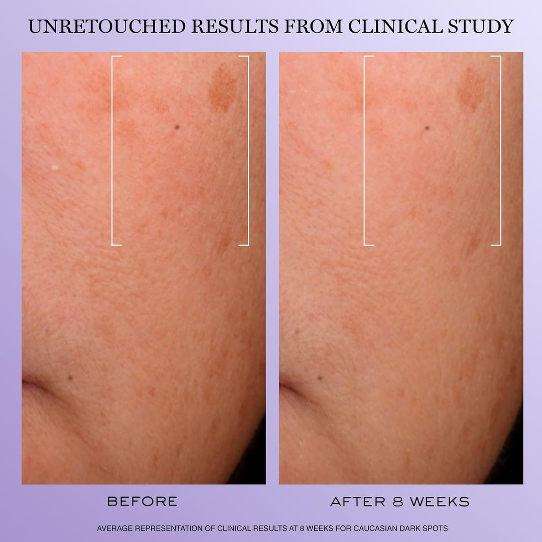 Lancôme Rénergie H.C.F. Triple Serum - Suero de ácido hialurónico p...