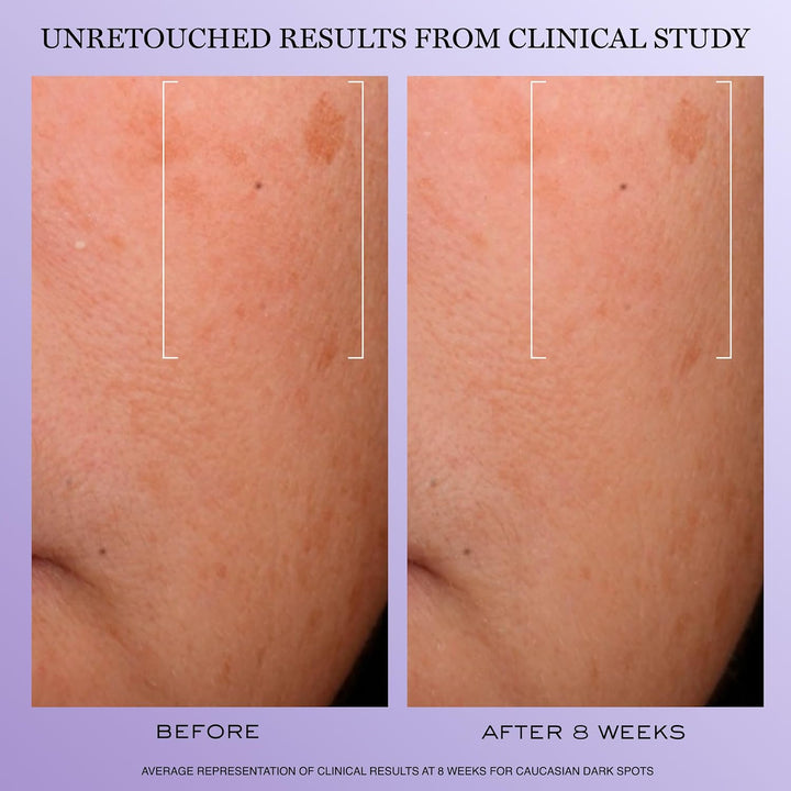 Lancôme Rénergie H.C.F. Triple Serum - Suero de ácido hialurónico p...