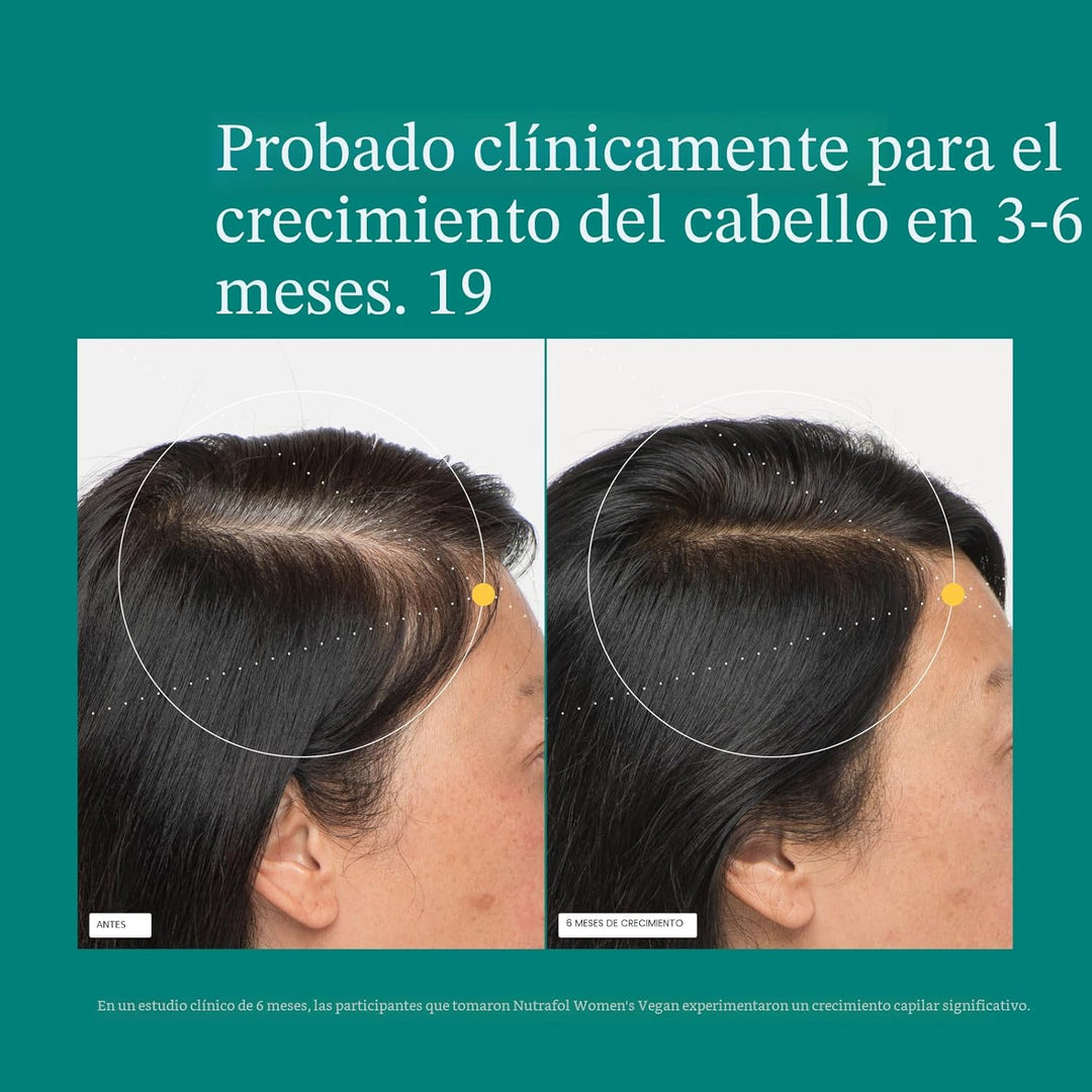 Nutrafol - Suplementos de crecimiento del cabello para mujeres de 1...