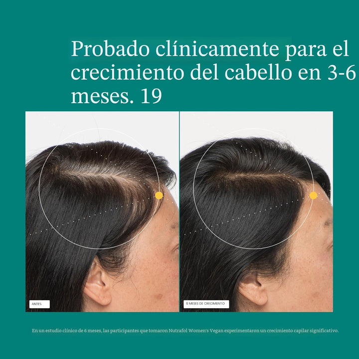 Nutrafol - Suplementos de crecimiento del cabello para mujeres de 1...