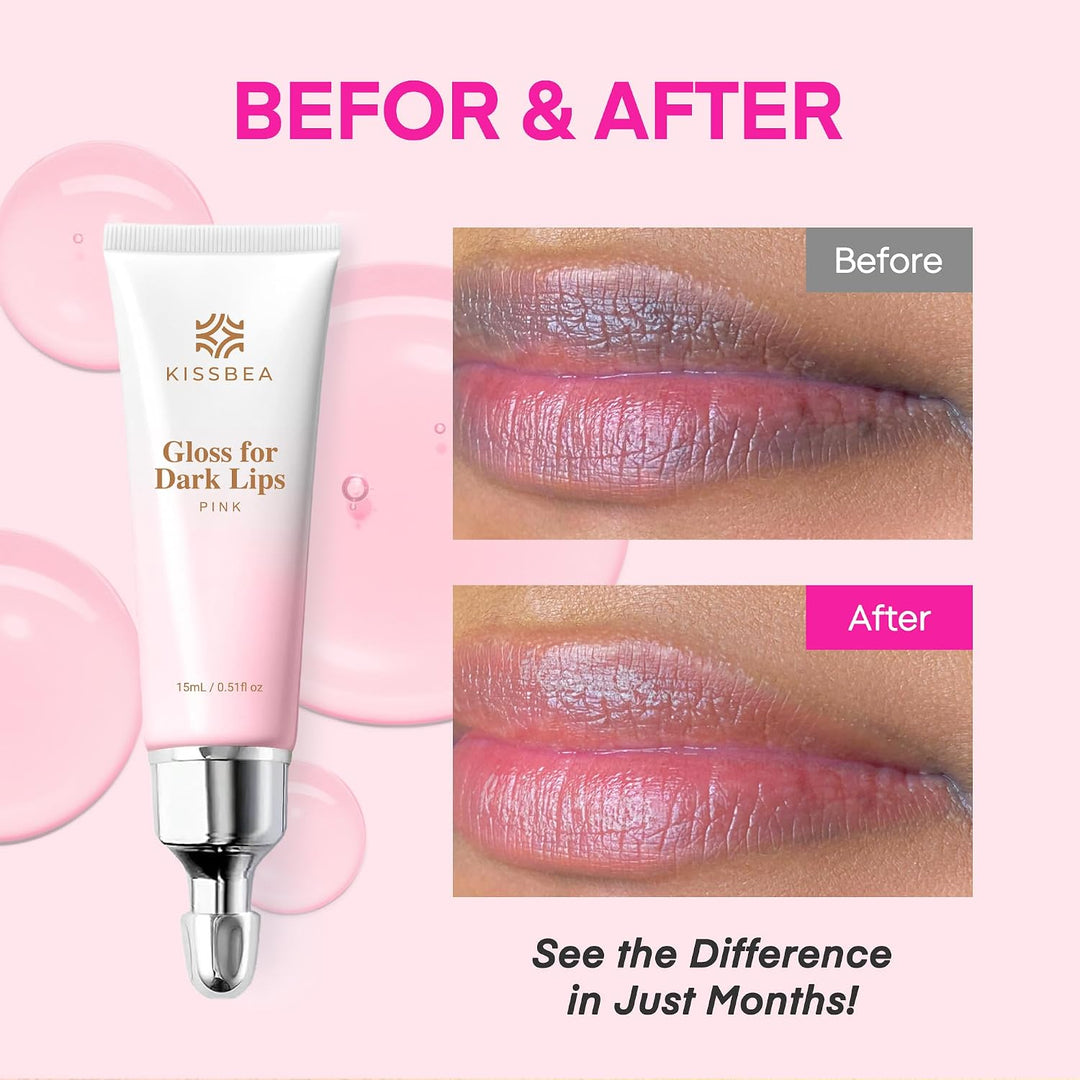 KissBea Aclarador de labios para labios oscuros: para fumadores, la...