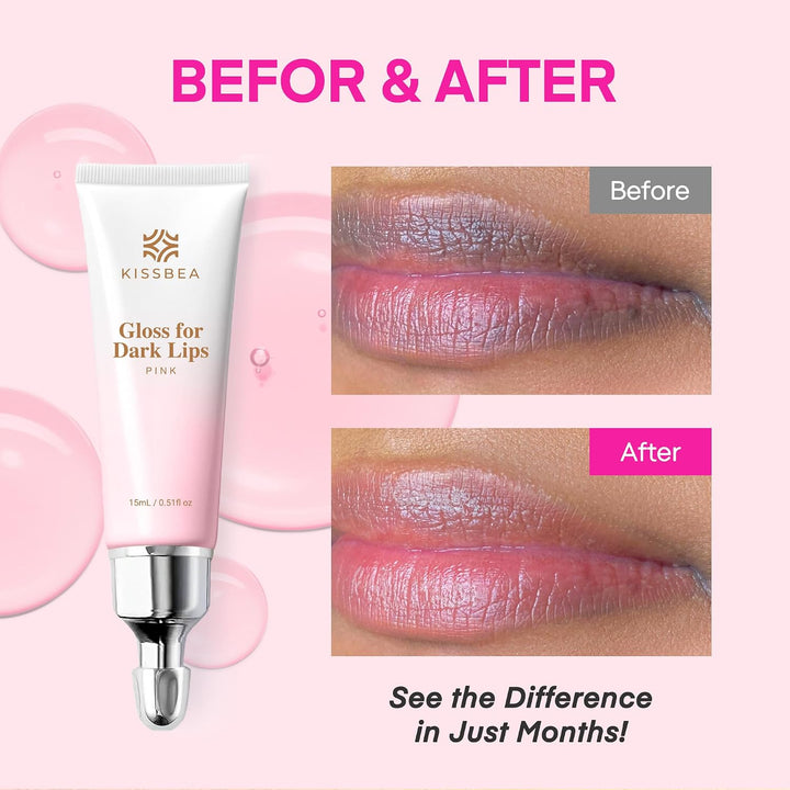 KissBea Aclarador de labios para labios oscuros: para fumadores, la...