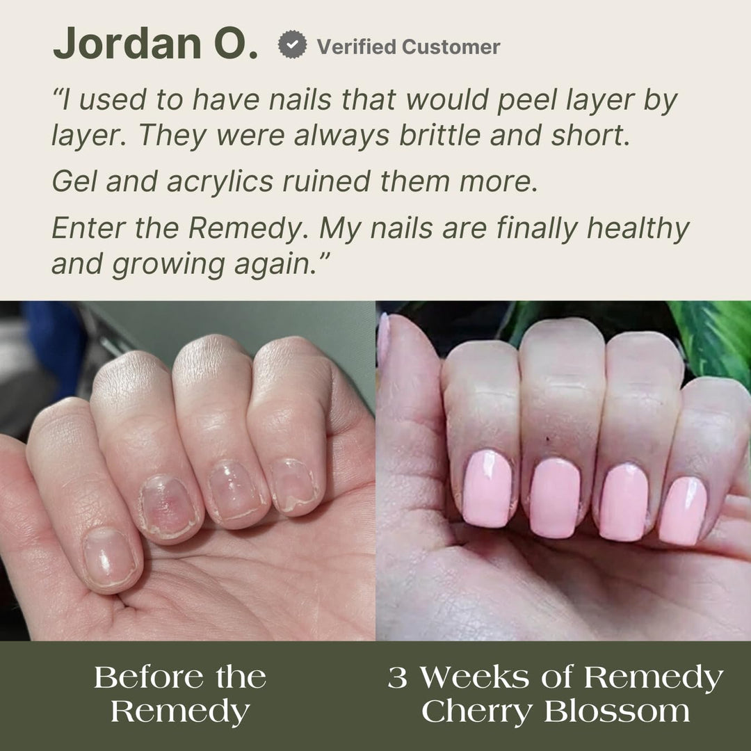Botanist The Remedy | Esmalte fortalecedor para uñas | Repara y end...