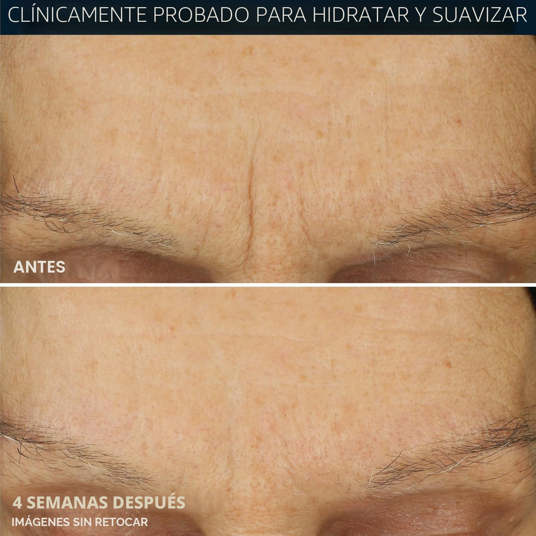 RoC Retinol Correxion Max Hydration - Hidratante facial diario anti...