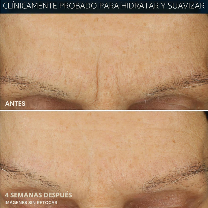 RoC Retinol Correxion Max Hydration - Hidratante facial diario anti...