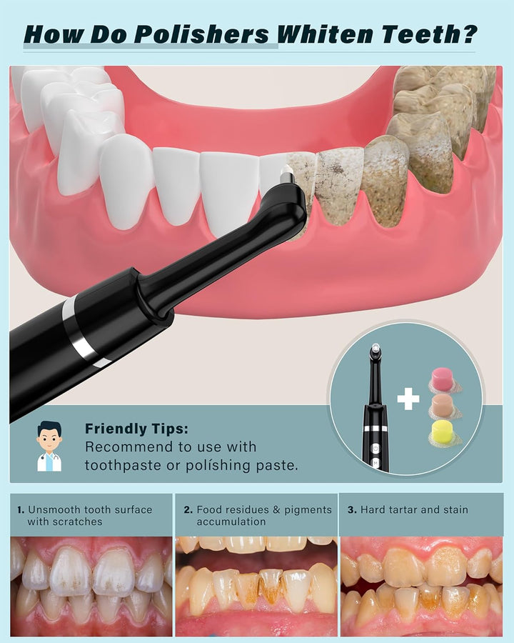 Pulidor de Dientes, Kit Recargable de Blanqueamiento Dental para Li...