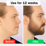 Estimulante para Barba \u2013 Bálsamo de Crecimiento Ultra Potente,...