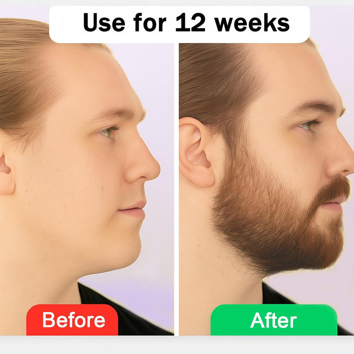 Estimulante para Barba \u2013 Bálsamo de Crecimiento Ultra Potente,...
